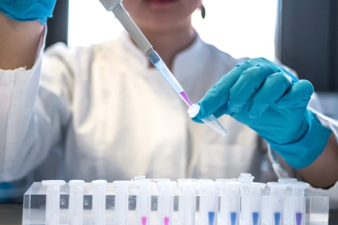 Pelotas Integra Estudo Internacional Que Investiga Avanço do Câncer de Intestino Entre Jovens
